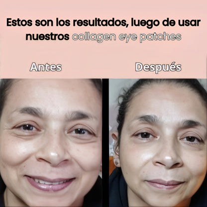 Parche ocular de Hidrogel